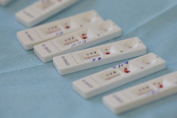 Testul rapid COVID-19 Antigen, dezvoltat și produs de o companie 100% românească! Rezultat în doar 15 minute