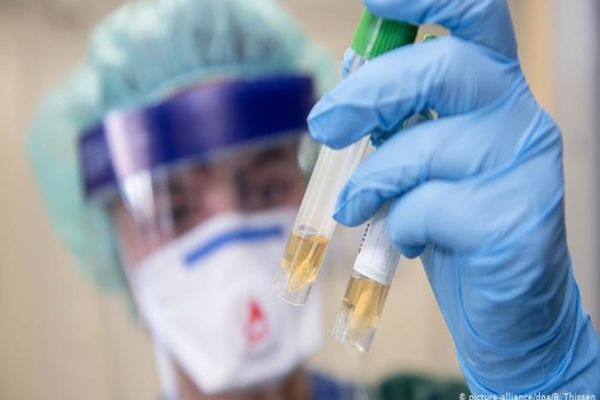 Câte zile ar trebui să aștepte o persoană după o posibilă expunere la COVID-19 pentru a fi testată?