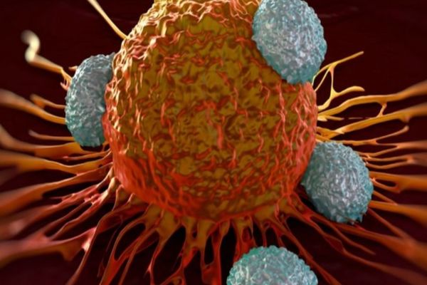 O vulnerabilitate în celulele canceroase, descoperită de o echipă internaţională de cercetători 