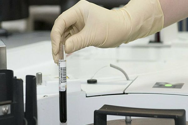  DSP Argeș, anchetă după ce un bărbat a decedat la o zi distanță după ce a făcut vaccinul Pfizer