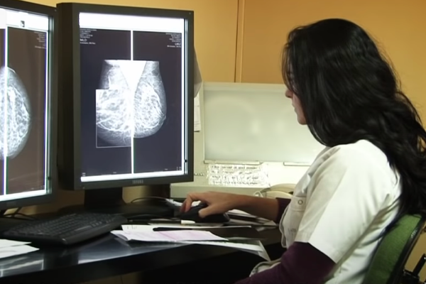 Mamografia şi/sau ecografia mamară