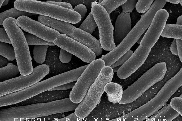 Infecția cu Escherichia coli (E.coli)