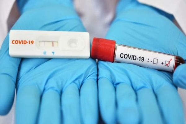 REGULI NOI pentru testarea Covid-19 la domiciliu, în Bucureşti