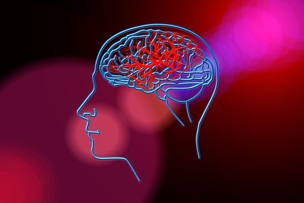 ACCIDENTUL VASCULAR CEREBRAL: 6 întrebări frecvente