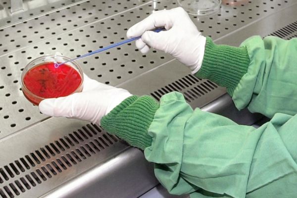 ALERTĂ SANITARĂ în România. Bărbat suspect de ANTRAX, internat în spital. De unde a luat virusul