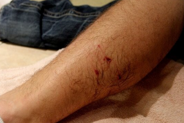 Primul ajutor în cazul mușcăturilor de animale