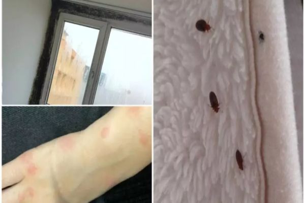 Invazie de ploșnițe! Cum recunoști mușcătura și ce trebuie să faci imediat ca să scapi de ele