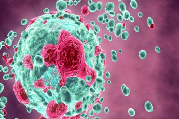 TEST GENETIC REVOLUȚIONAR ÎN MAREA BRITANIE: SCHIMBĂ DIAGNOSTICUL ȘI TRATAMENTUL PENTRU MIELOMUL MULTIPLU