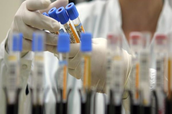CAMPANIE GRATUITĂ DE TESTARE HPV LA SCJU TÂRGU MUREȘ PENTRU FEMEILE ÎNTRE 25 ȘI 65 DE ANI