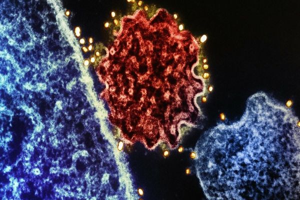 OMS: Riscul de răspândire a virusului mortal Nipah în afara Infiei este scăzut