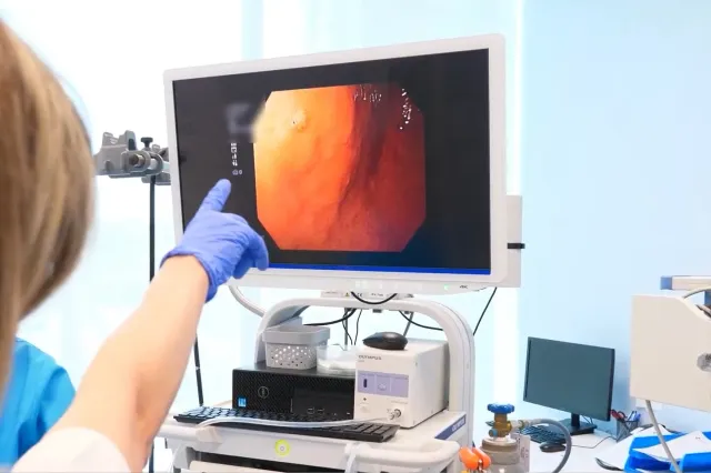 Rolul colonoscopiei in diagnosticul și prevenția cancerului de colon