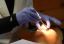 Sensibilitatea dentară: de ce apare și cum poate fi prevenită