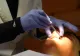 Sensibilitatea dentară: de ce apare și cum poate fi prevenită