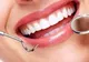 Cele mai frecvente probleme dentare