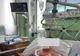 Primul tratament cu plasmă umană hiperimună de la SCJU Sibiu, aplicat unui pacient de 48 ani
