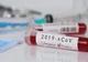 Israelul a testat cu succes două medicamente împotriva COVID-19