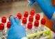 Un studiu genetic coordonat de Emiratele Arabe Unite a identificat 70 de mutaţii ale SARS-CoV-2
