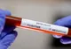 Cazuri noi de coronavirus la ISU Giurgiu și la Ambulanță