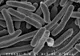 Infecția cu Escherichia coli (E.coli)