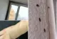 Invazie de ploșnițe! Cum recunoști mușcătura și ce trebuie să faci imediat ca să scapi de ele