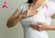Sabia cu două tăișuri a cancerului de sân: molecula care îl ascunde îl expune și la medicamente