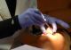 Sensibilitatea dentară: de ce apare și cum poate fi prevenită