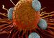 O vulnerabilitate în celulele canceroase, descoperită de o echipă internaţională de cercetători 
